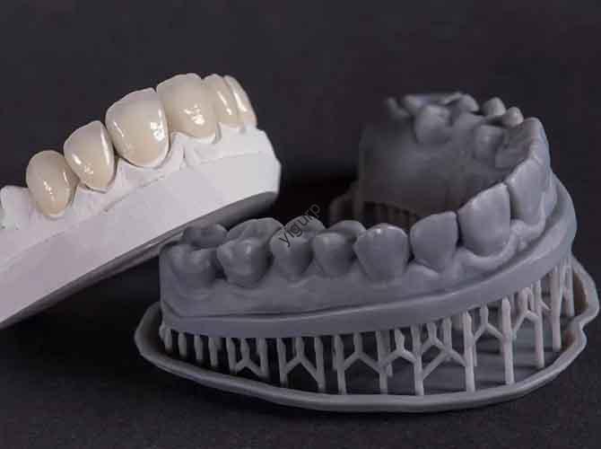 dental 3d printing